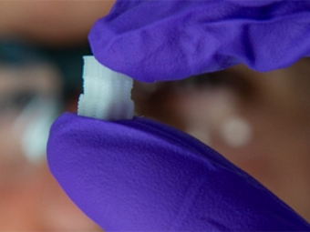 [b]Osteoxondronal toxumanın bərpası üçün - 3D İMPLANTI[/b]