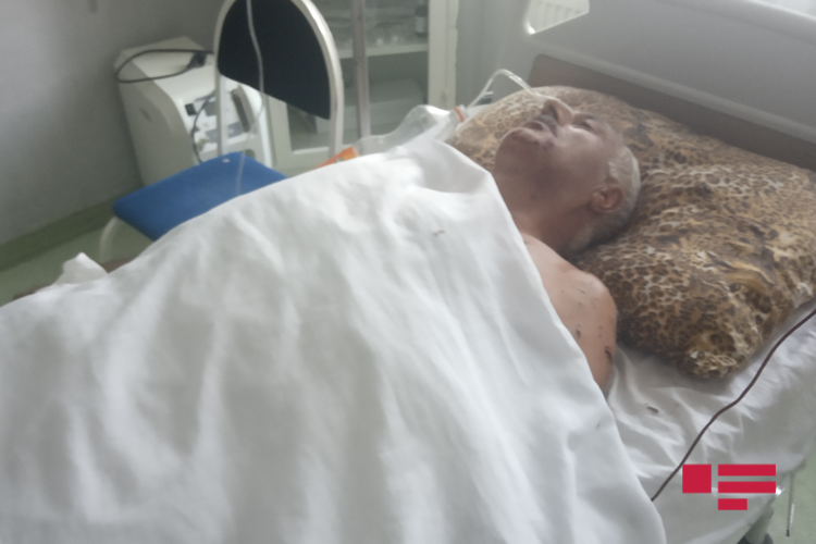 55 yaşlı kişinin əlində qumbara  partladı:ölən var  - YENİLƏNİB