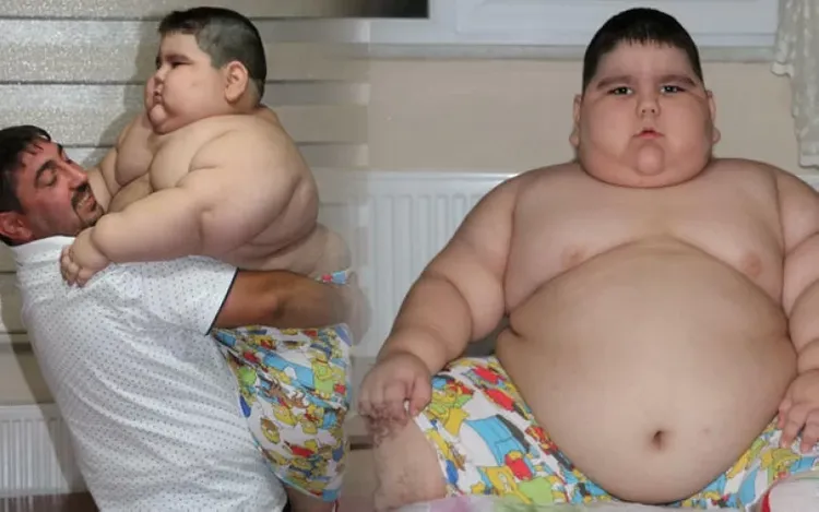 4 yaşı var, çəkisi anasından 5 kiloqram azdır