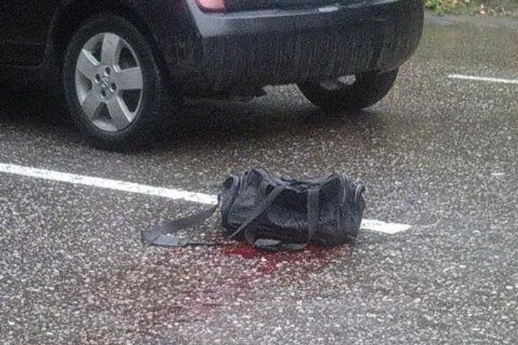 Bakıda xanım sürücü piyada qadını vurdu