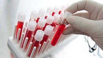 Bu il 43 tondan artıq qan tədarük olunub - RƏSMİ