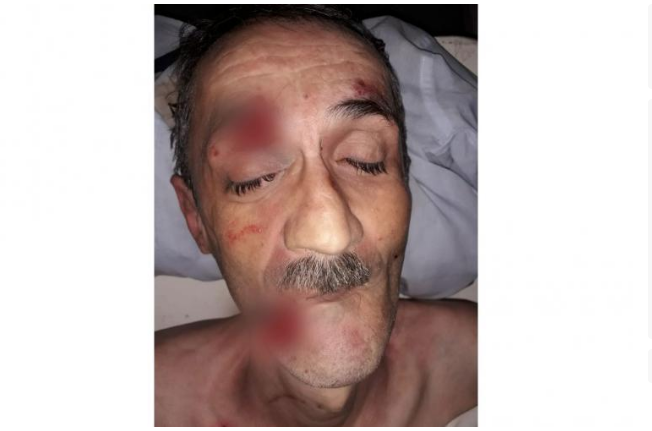 Xırdalanda küçədə ölənin yaxınları axtarılır - FOTO