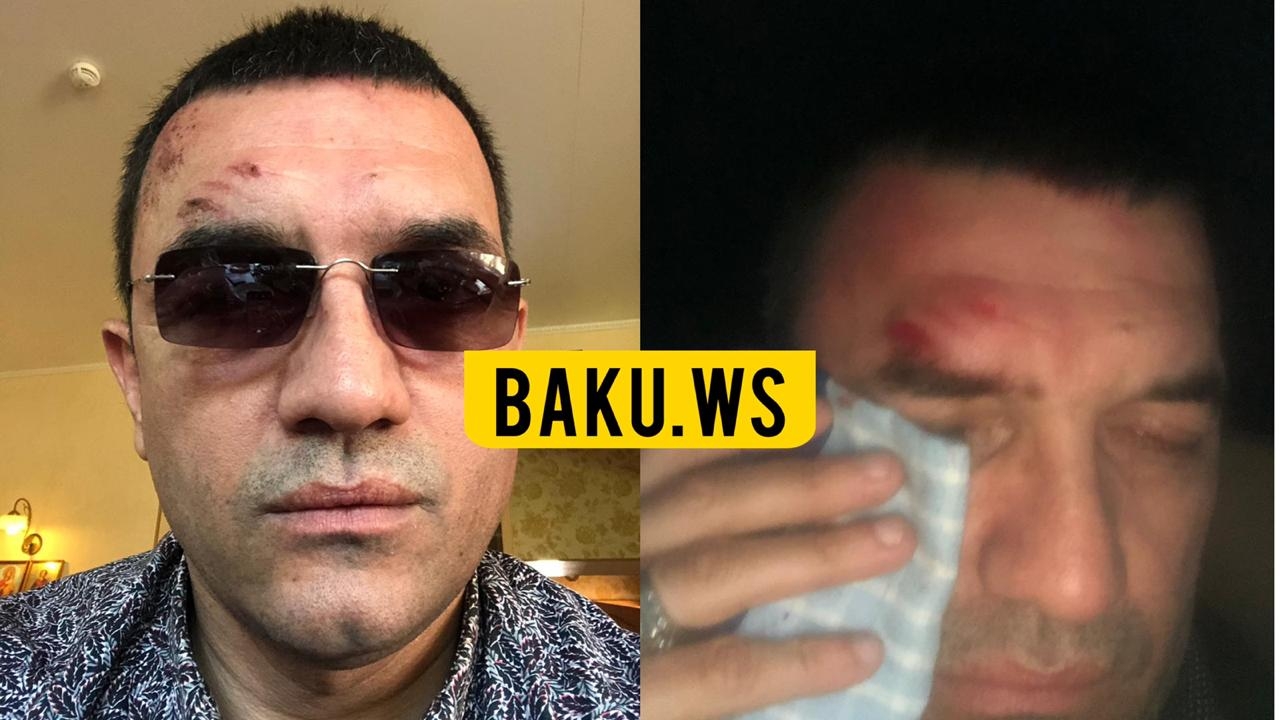 Tanınmış azərbaycanlı meyxanaçı QƏZAYA DÜŞÜB - FOTO