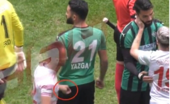 [b]Futbolçu rəqiblərinə ülgüclə xəsarət yetirib - Türkiyədə[/b]