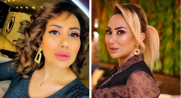 Təranə dəyişildi, tanımadılar - FOTO 