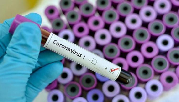 Koronavirusa belə də yoluxa bilərsiniz - YENİ ARAŞDIRMA