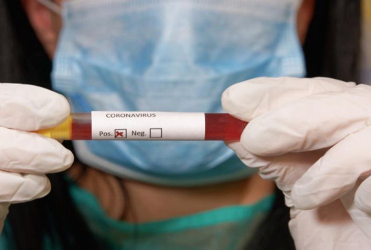 Ukraynada daha 206 nəfər koronavirusa yoluxdu