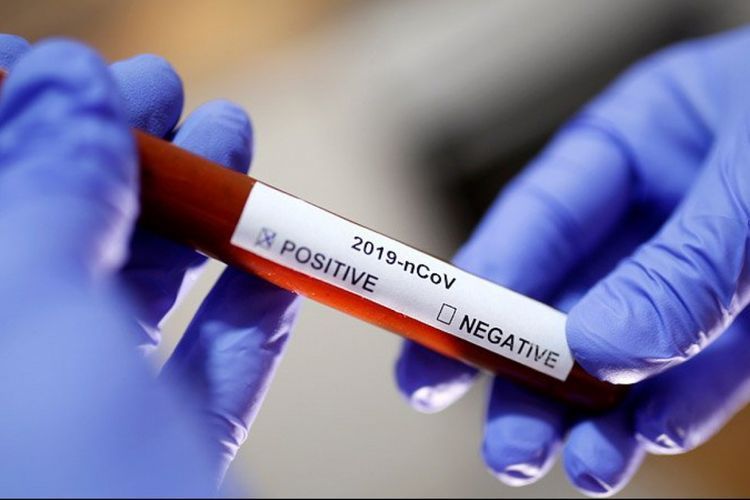 Rusiyada koronavirusun yeni üsulla MÜALİCƏSİ
