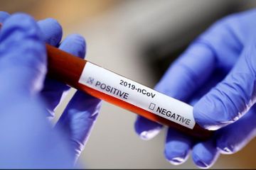 Koronavirus bu ölkəyə də çatdı