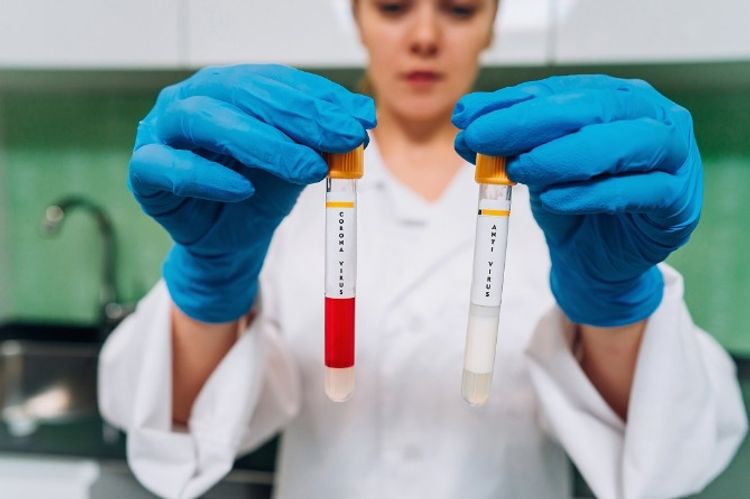 Ukraynada koronavirusdan ölənlərin sayı 90-ı keçdi
