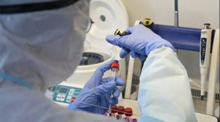 İtaliyada koronavirus peyvəndinin sınağına yayda başlanılacaq