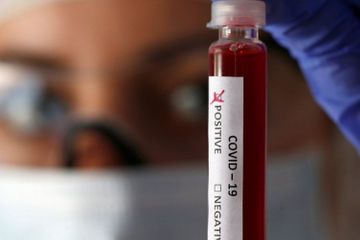 ABŞ-da koronavirusdan ölənlərin sayı 46 785 nəfərə çatdı