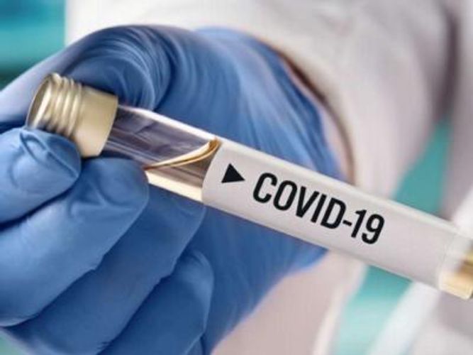 Rusiyada daha 108 nəfər koronavirusdan öldü
