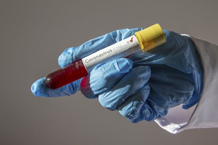 İranda daha 215 nəfər koronavirusdan öldü