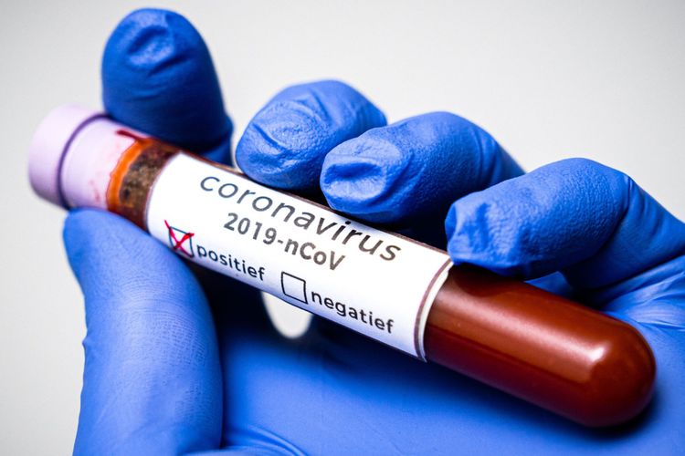 ABŞ-da koronavirusdan daha 540 nəfər öldü