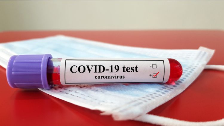 İranda bir sutkada koronavirusdan 189 nəfər öldü