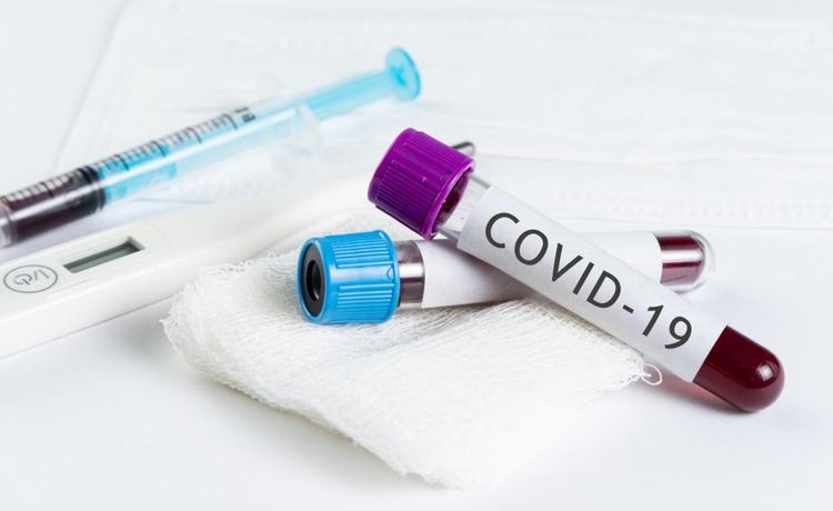 Koronavirusa yoluxmada artımın səbəbi AÇIQLANDI