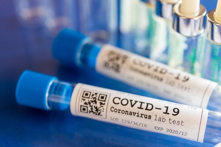 Rusiyada son sutkada koronavirus 119 nəfəri öldürüb