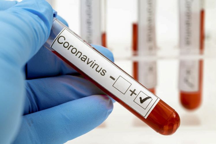 Rusiyada koronavirusa yoluxanların sayı 950 mini ötdü