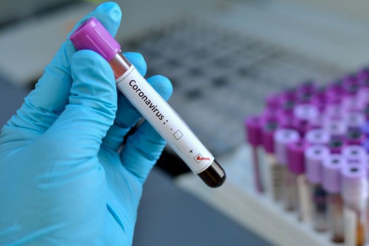 Gürcüstanda koronavirusa yoluxanların sayı 1 462 nəfərə çatdı