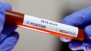 Türkiyə və İran səhiyyə nazirləri koronavirus təhlükəsindən danışıblar
