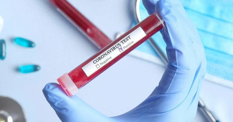 Koronavirusun genetik kodu aşkarlandı - RƏSMİ