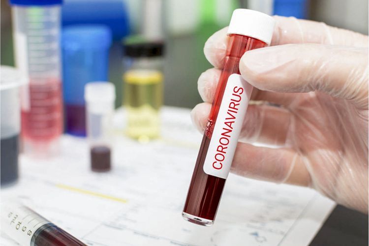 ABŞ-da koronavirus bir sutkada 1300-dən çox adamı öldürdü