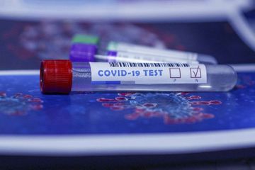 Koronavirus Ermənistanda 10 nəfəri də öldürdü