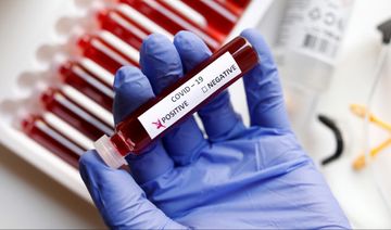 Koronavirus Ermənistanda 10 nəfəri də öldürdü
