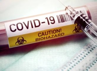 Bakı metrosunun 29 əməkdaşı koronavirusa yoluxdu, bir nəfər öldü