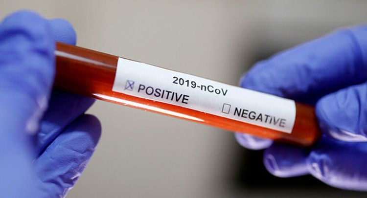 Bir ailənin 28 üzvü koronavirusa yoluxdu