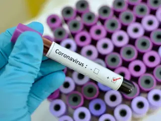 Gürcüstanda koronavirusa yoluxanların sayı 4-ə çatdı