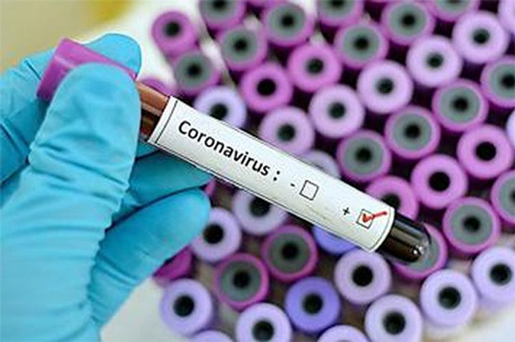 Ermənistanda koronavirusa yoluxanların sayı 8-ə çatdı