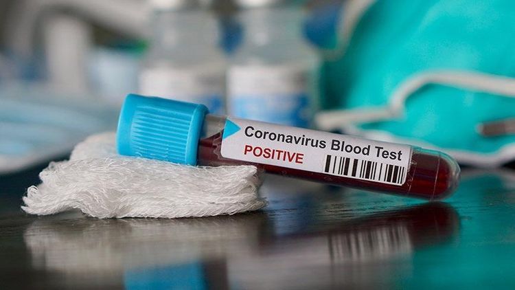 TƏBİB: Koronavirus testinin şəxsi istəyə bağlı olunmaması tövsiyə edilir