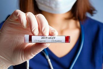 Bu sosial şəbəkə istifadəçiləri barədə ciddi tədbirlər görüləcək - BİRGƏ MƏLUMAT