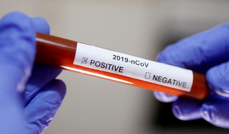 Rusiyada koronavirusdan bir sutkada 8 nəfər öldü