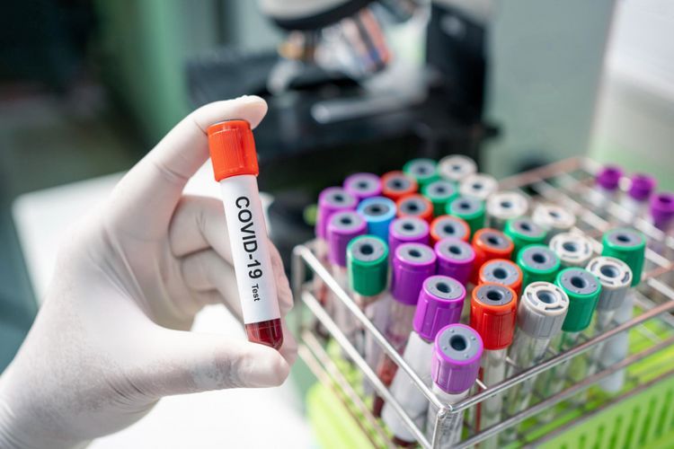 Dünyada koronavirusa yoluxanların sayı 3,4 milyonu keçdi