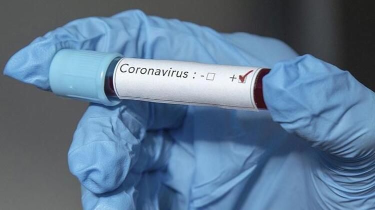  İranda koronavirusdan ölənlərin sayı 6 277 nəfərə çatdı