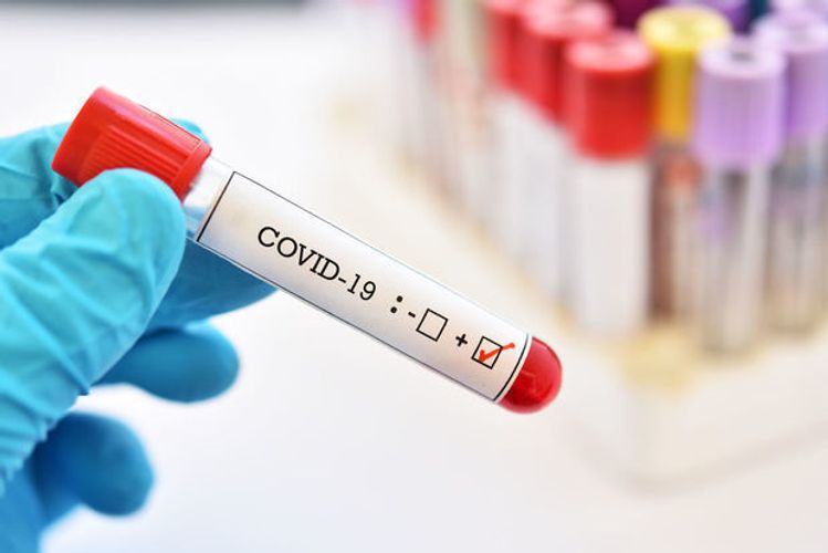 ABŞ-da koronavirusdan ölənlərin sayı 68636 nəfərə çatdı