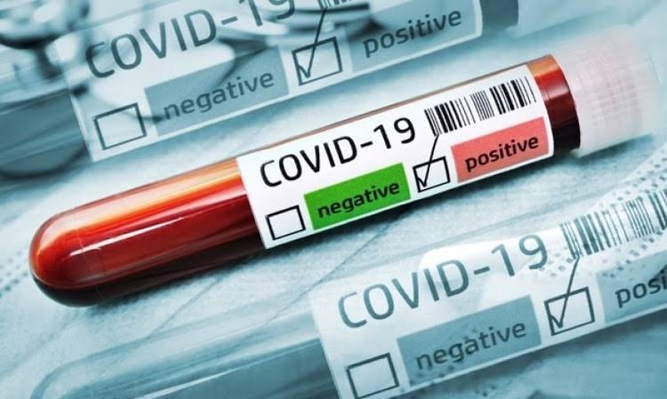Britaniyada koronavirusdan ölənlərin sayı 204 nəfər də artdı