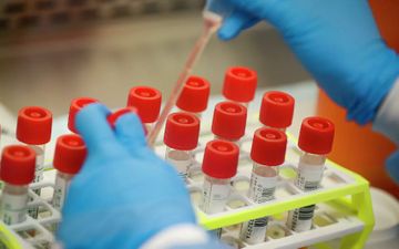 ABŞ-da minlərlə hərbçi və ailə üzvlərində koronavirus aşkarlandı