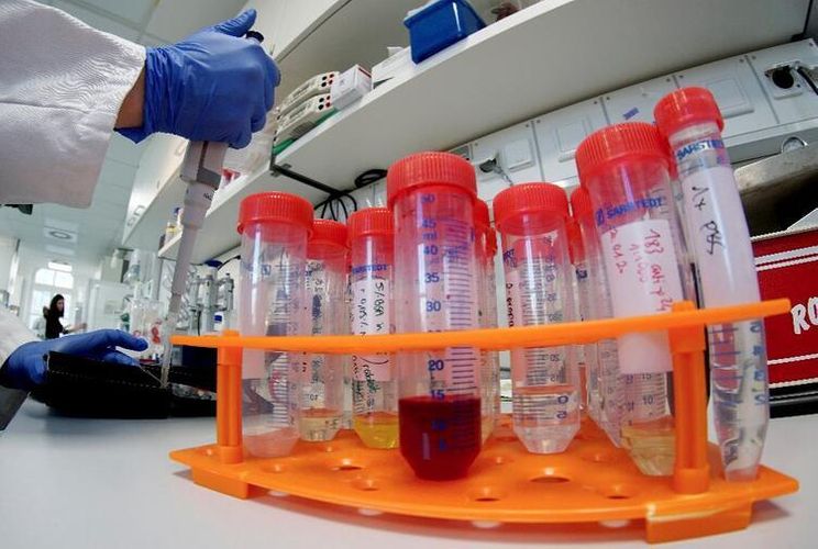 Rusiyada daha 96 nəfər koronavirusdan öldü