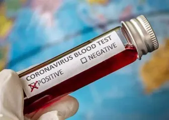 Azərbaycan pandemiya ilə mübarizədə bu ölkələrə yardım edib - SİYAHI 