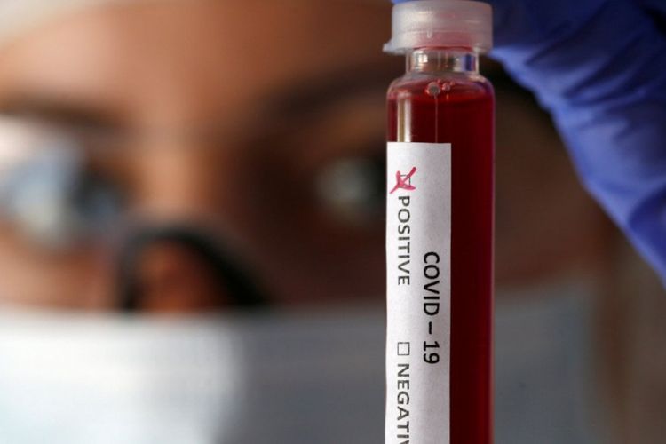 Bu ölkədən Azərbaycana qayıdan 29 nəfərdə koronavirus aşkarlandı