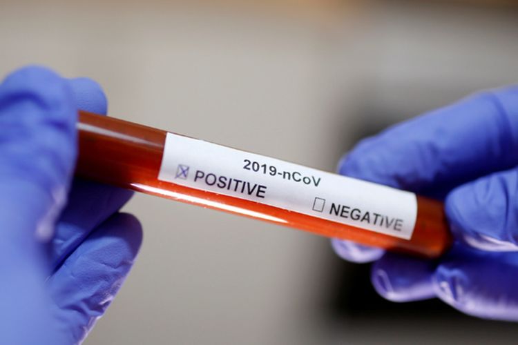 Rusiyada daha 91 nəfər koronavirusdan öldü