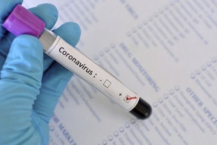 Türkiyədə gizli yas mərasimində 163 nəfər koronavirusa yoluxub