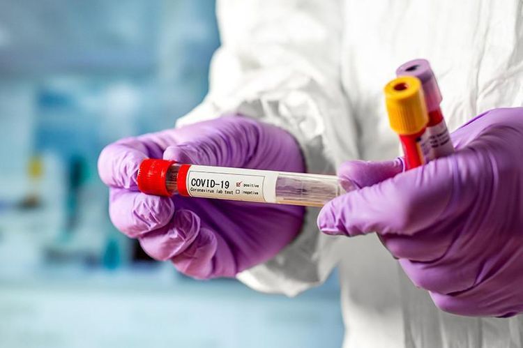 ABŞ-da bir sutkada koronavirusdan 700-ə yaxın adam ölüb