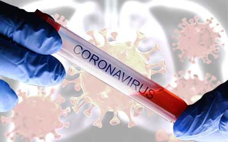 Azərbaycanda daha 165 nəfərdə koronavirus aşkarlandı, 78 nəfər sağaldı, 2 nəfər öldü