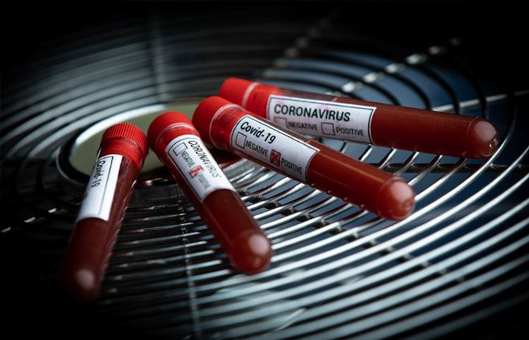 Azərbaycanda daha 248 nəfərdə koronavirus aşkarlandl, 101 nəfər sağaldı, 2 nəfər vəfat etdi