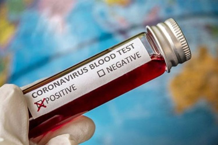 Gürcüstanda daha 20 nəfər koronavirusdan öldü